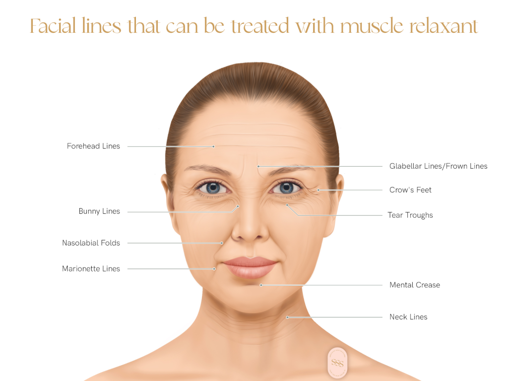 4 Things That Cause Wrinkles & How to Prevent Them