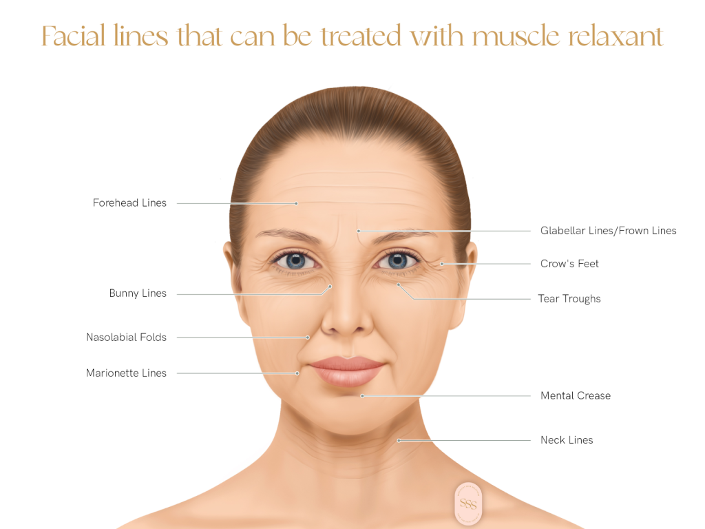 Fine Lines and Wrinkles: Causes and How to Treat