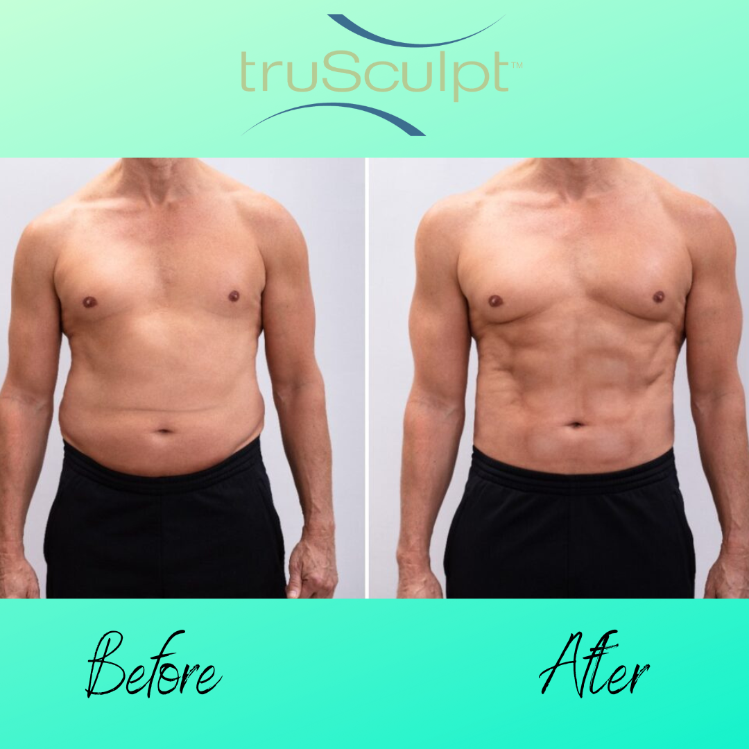 truscult for men to achieve the personalised results you desire